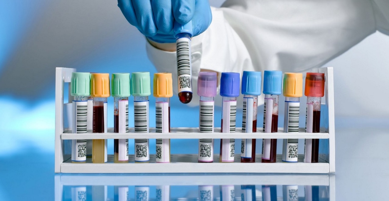 Precio para interpretación de laboratorios 